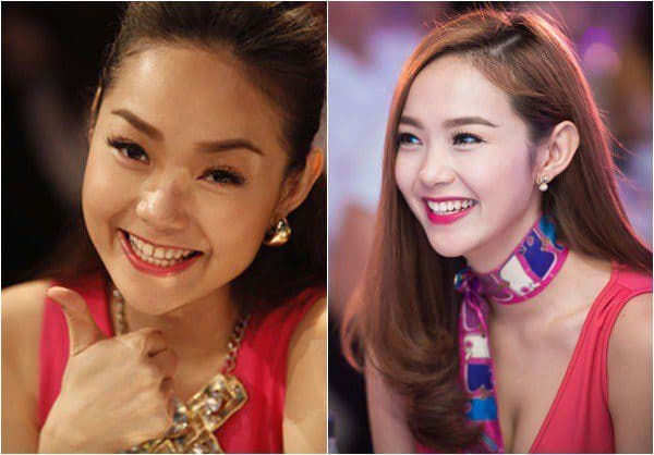 niềng răng Invisalign ở Thu Cúc