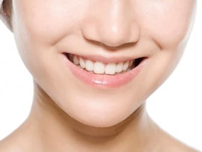 Niềng răng là giải pháp giúp khắc phục các khuyết điểm của răng, đem lại vẻ đẹp thẩm mỹ hoàn hảo cho hàm răng của bạn.