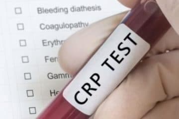 protein phản ứng c còn gọi là CRP