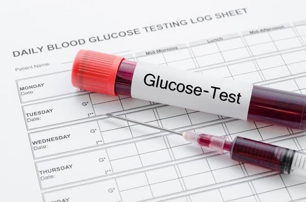 không phải ai cũng biết định lượng glucose trong máu là gì?