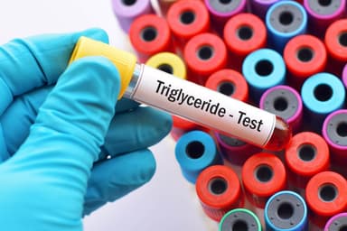 Định lượng triglycerid ở đâu TỐT?
