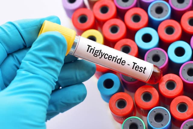 Định lượng triglycerid ở đâu TỐT?
