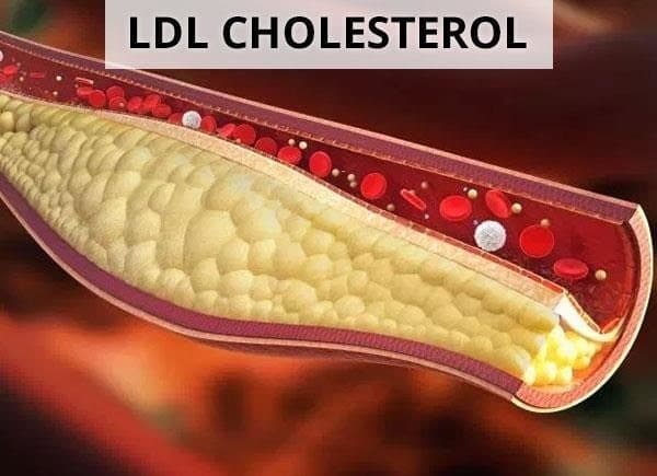 cách giảm ldl cholesterol 