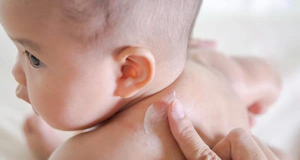 Sử dụng thuốc bôi hoặc thuốc uống đặc trị nấm malassezia. Loại thuốc sử dụng để uống hoặc bôi cho trẻ cần được sự tư vấn từ bác sĩ.