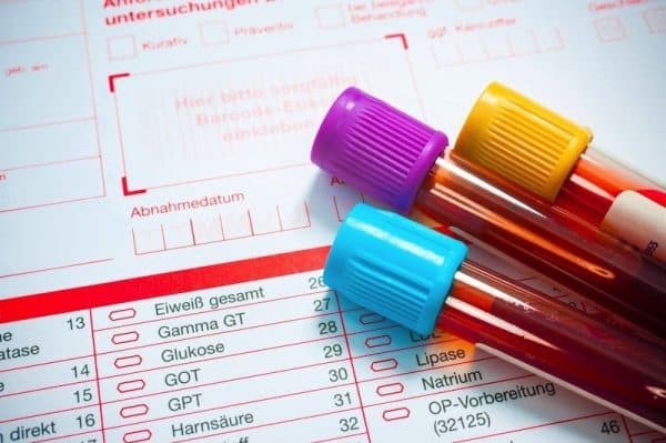 Chỉ số xét nghiệm SGPT (ALT) giúp đánh giá lượng men gan và tình trạng thương tổn ở gan (ảnh minh họa)