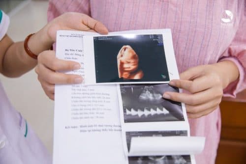 Hình ảnh siêu âm 5D