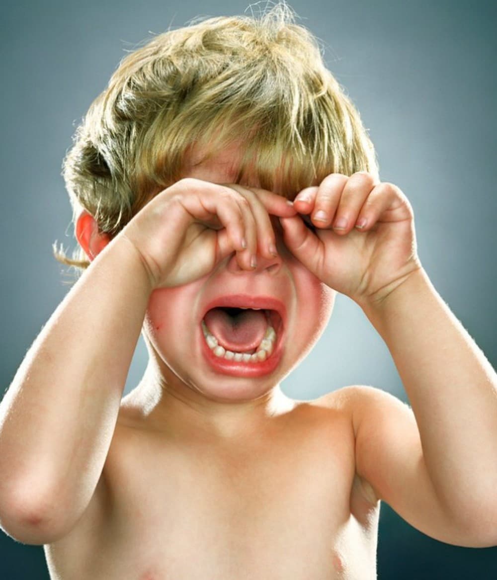 Hẹp bao quy đầu khiến trẻ tiểu khó, tiểu tia nước nhỏ… thậm chí dẫn đến sưng đau ở đầu dương vật (ảnh minh họa)