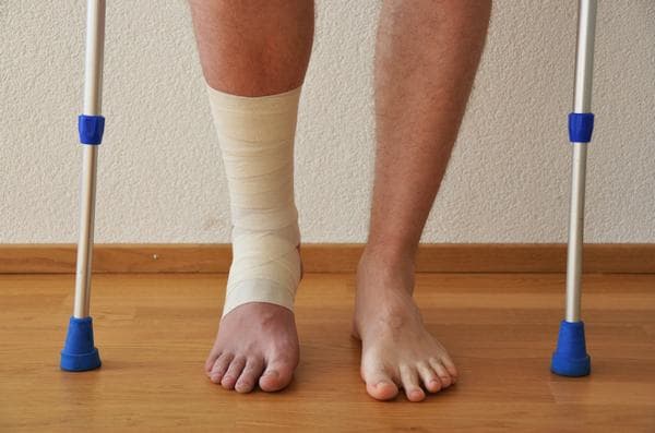 Người bệnh cần luyện tập sau gãy xương để nhanh hồi phục 