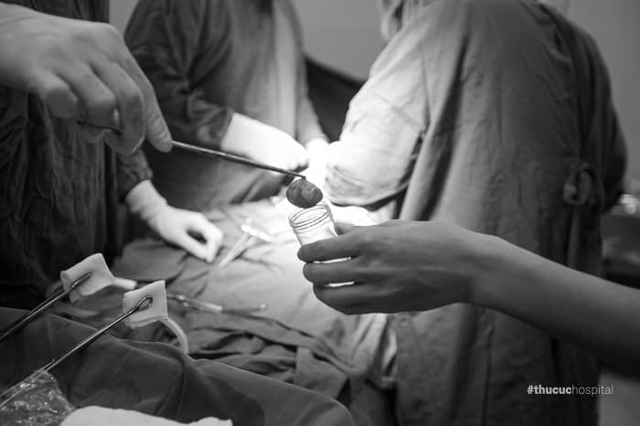 mổ đẻ kết hợp bóc u nang buồng trứng