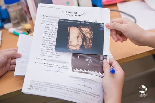 siêu âm 5D có hại không