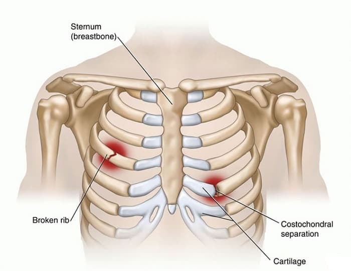 Xương sườn người có bao nhiêu cái?
