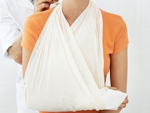 Gãy Xương Tay Có Quan Hệ Được Không &amp; Làm Gì cho Mau Lành?