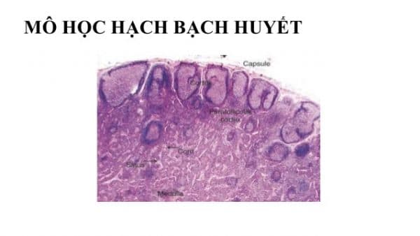 mô hạch bạch huyết