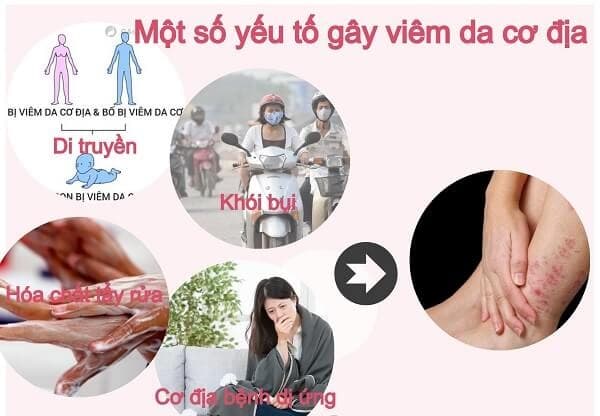 nguyên nhân gây viêm da cơ địa
