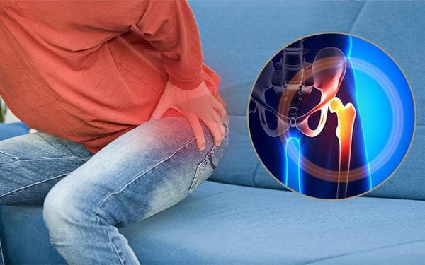 Trật khớp háng &#8211; nguyên nhân và cách xử lý