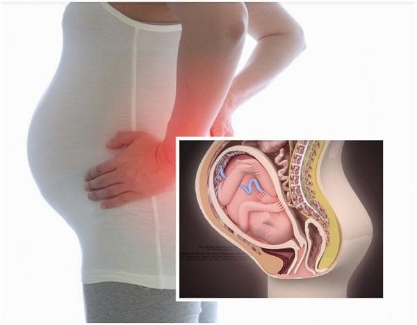 Nghỉ ngơi hợp lý và sinh hoạt khoa học giúp giảm đau xương mu hiệu quả