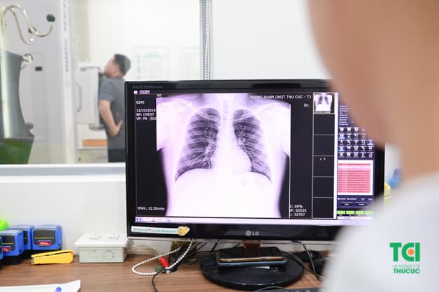 Anh Trọng đang thực hiện chụp X-quang ngực thẳng để phát hiện các dấu hiệu bệnh lý bất thường ở khu vực tim phổi