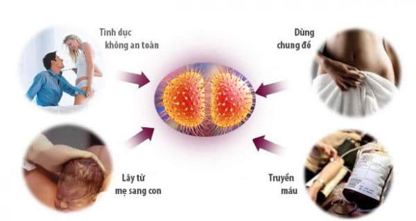 bệnh lậu lây qua đường nào để phòng tránh