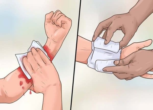 Sơ cứu vết thương chảy máu làm những gì