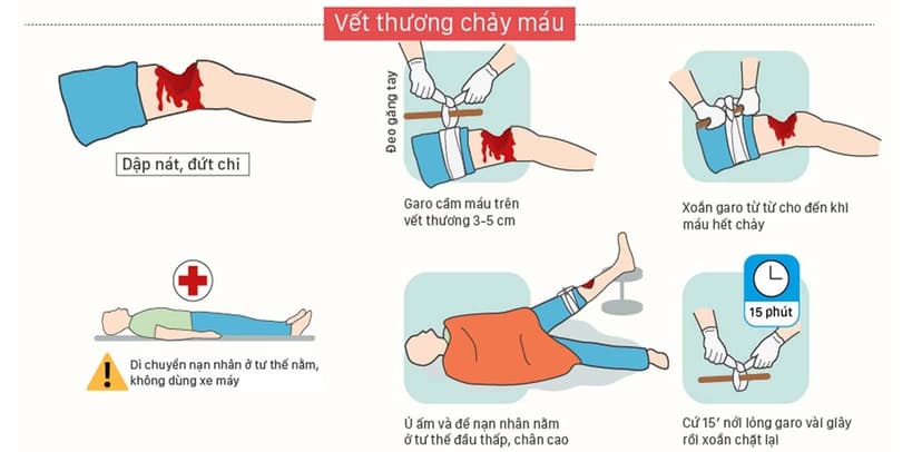 Để sơ cứu vết thương chảy máu hãy đọc ngay cách sau