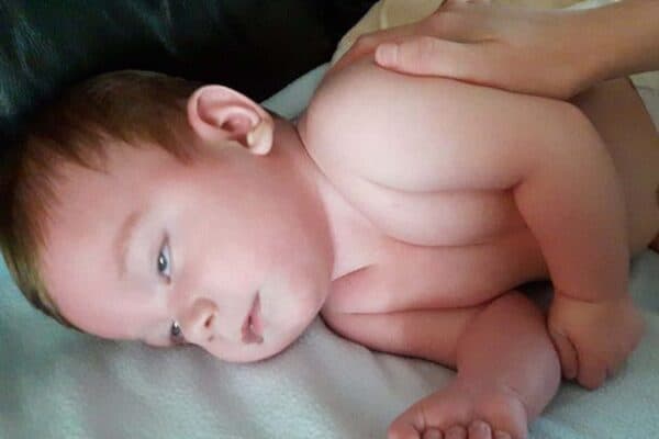 trẻ sơ sinh bị co giật