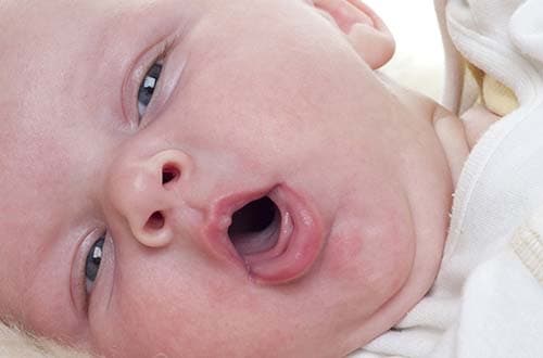 triệu chứng ho gà ở trẻ em ở giai đoạn đầu 