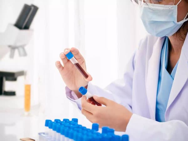 xét nghiệm sắt huyết thanh