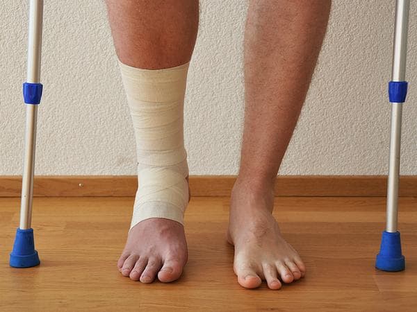 Người bệnh cần chú ý luyện tập sau gãy để nhanh hồi phục