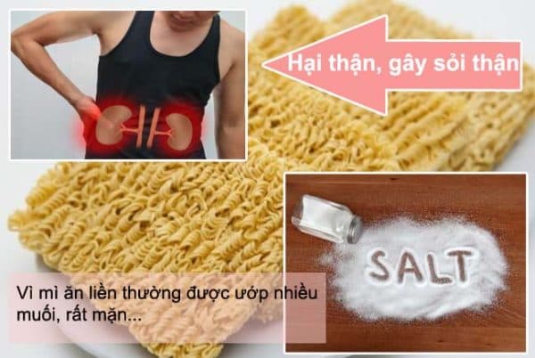 Tại sao mì tôm có thể gây sỏi thận