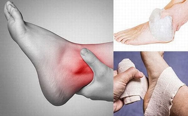 Cần sơ cứu đúng cách để giảm đau và ngừa biến chứng 