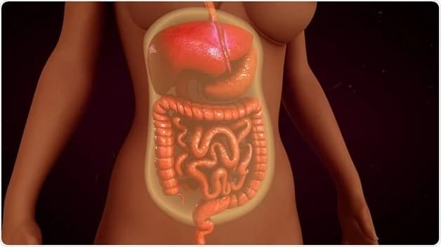 Bệnh viêm phúc mạc