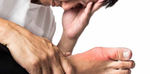 đối tượng dễ bị bệnh gout bệnh gút