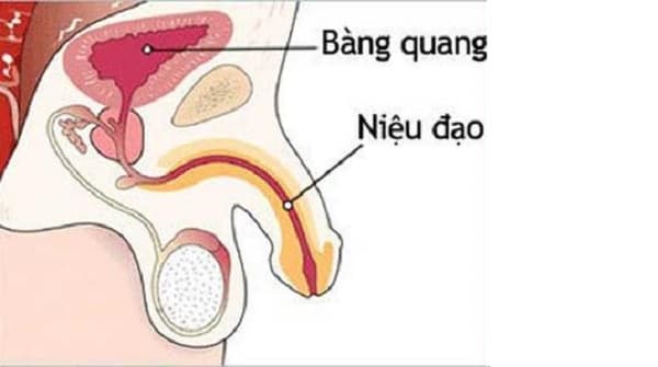 Hẹp đường niệu đạo ở trẻ em có thể là một trong những nguyên nhân khiến trẻ bị bí tiểu, ngoài ra còn rất nhiều những nguyên nhân khác