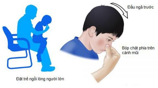 trẻ bị chảy máu cam