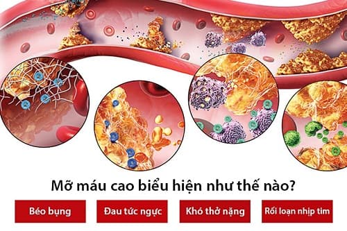 Triệu chứng máu nhiễm mỡ