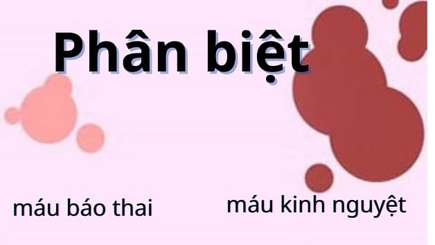 Ở nhiều chị em, dấu hiệu có thai cũng tương tự như sắp đến kỳ kinh nguyệt 