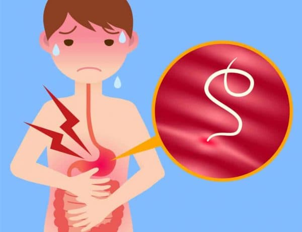 xét nghiệm giun sán ở trẻ em