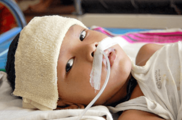 biến chứng viêm não ở trẻ em