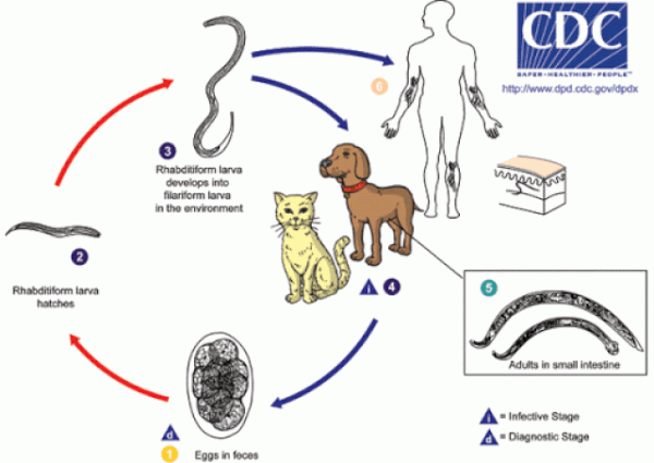 viêm não vì nhiễm giun đũa chó mèo