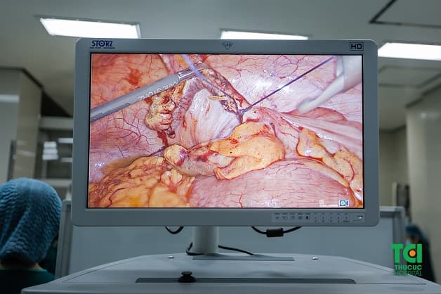 Qua giải đáp viêm ruột thừa viêm có nguy hiểm không hy vọng các bạn đã biết cách xử trí đúng nếu không may gặp phải tình trạng này. 