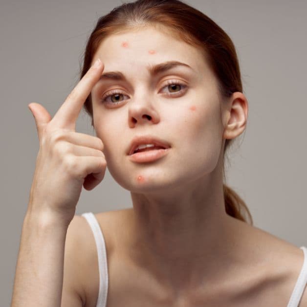 Dấu hiệu rối loạn nội tiết tố nữ thể hiện như thế nào?