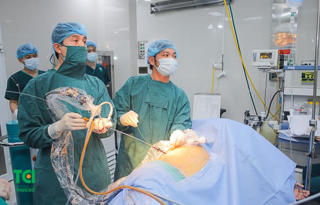 Cận cảnh ca tán sỏi qua da đường hầm nhỏ được thực hiện tại Bệnh viện ĐKQT Thu Cúc.