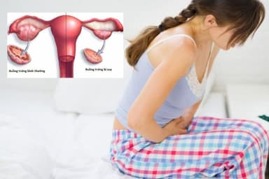 Cần làm những gì để chẩn đoán suy buồng sớm ở phụ nữ?