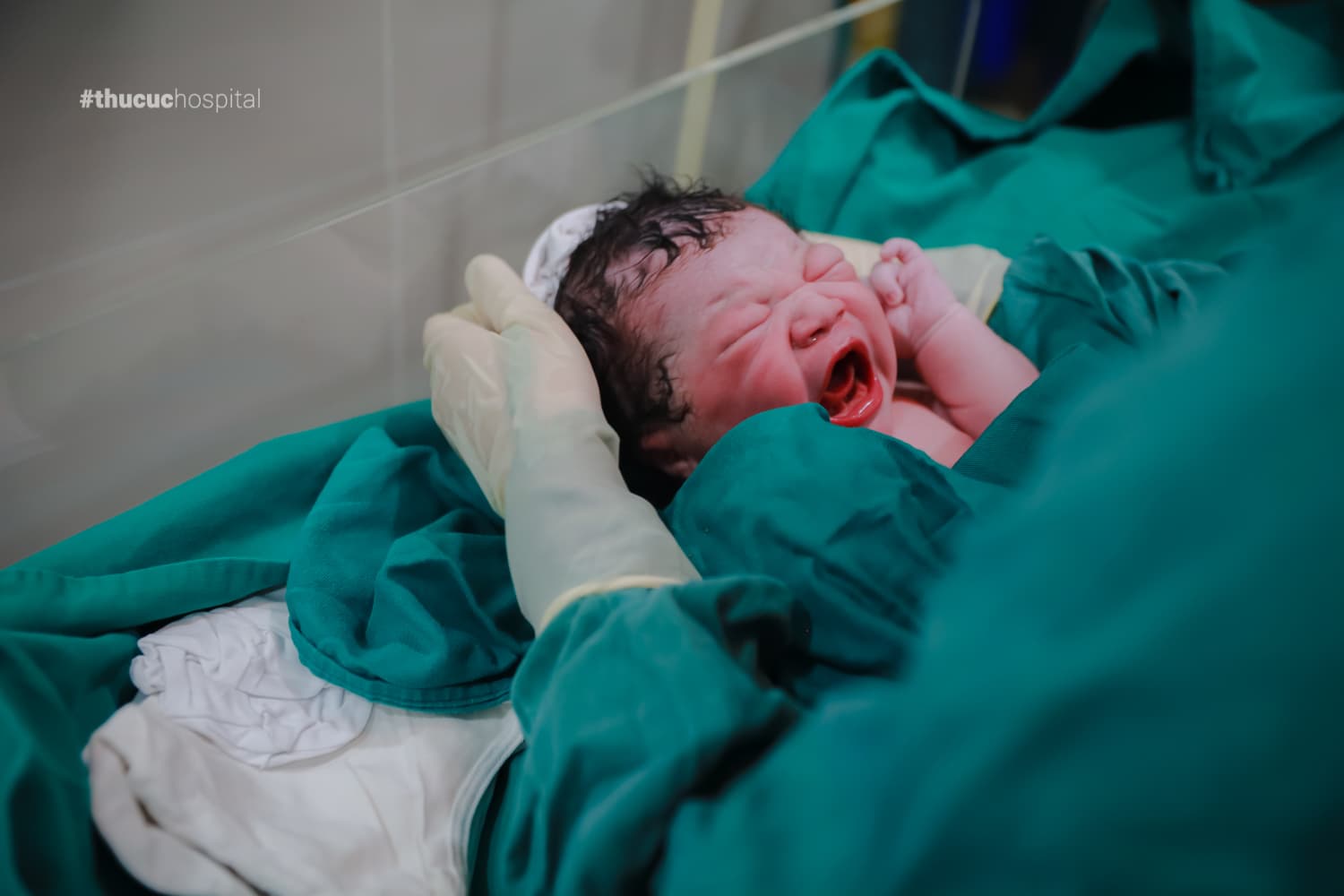 Đa ối và dư ối có khác nhau không? - Các em bé sinh từ mẹ bầu đa ối thường có cân nặng lớn hơn mức bình thường