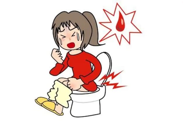 dấu hiệu sa trực tràng