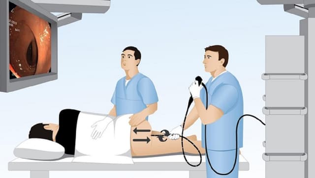 &#8220;Giải tỏa&#8221; nỗi lo: nội soi đại trực tràng có đau không? 