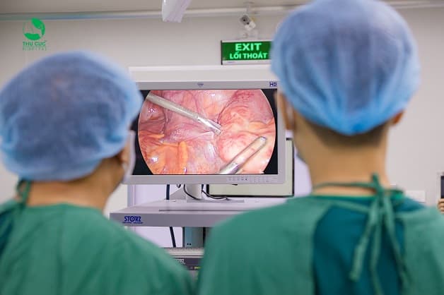 Phẫu thuật cắt ruột thừa bằng phương pháp mổ nội soi