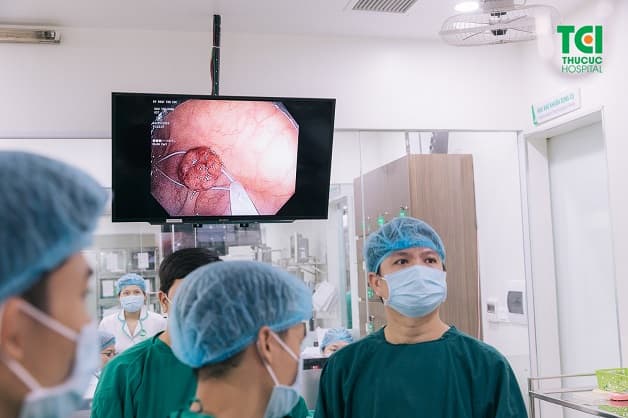 Polyp có thể được cắt ngay trong quá trình nội soi