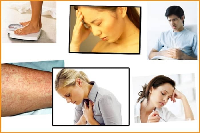 Một số triệu chứng điển hình có thể bắt gặp ở bệnh nhân rối loạn chức năng gan