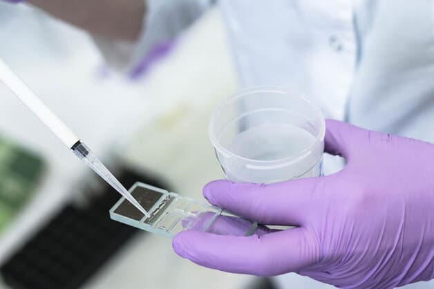 kiểm tra tinh dịch đồ